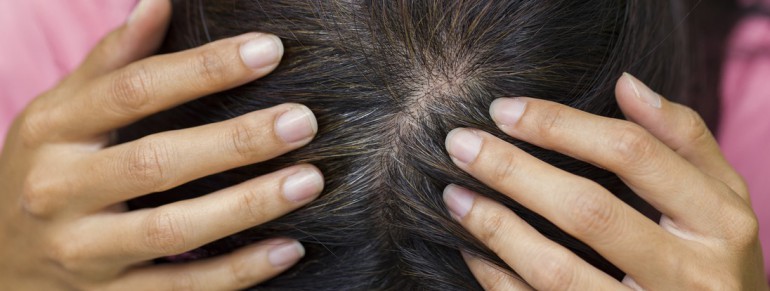 De beaux cheveux commence par un cuir chevelu sain